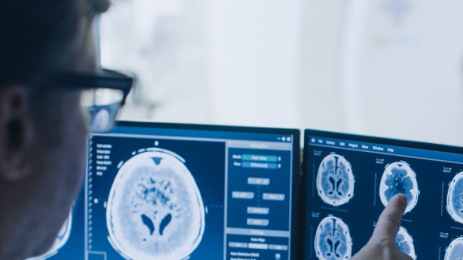 tratamiento antidepresivo tumor cerebral