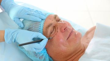 Hombre se vuelve viral después de someterse a una cirugía de ojo inclinado