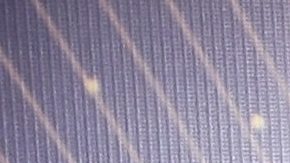 Lucía Méndez padece una influenza severa, y es tratada con oxígeno para abordar la complicación respiratoria.