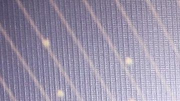 Lucía Méndez padece una influenza severa, y es tratada con oxígeno para abordar la complicación respiratoria.