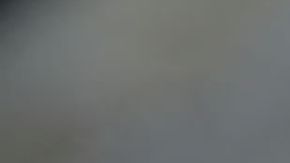 Joven con extraña enfermedad en la piel triunfa en Instagram