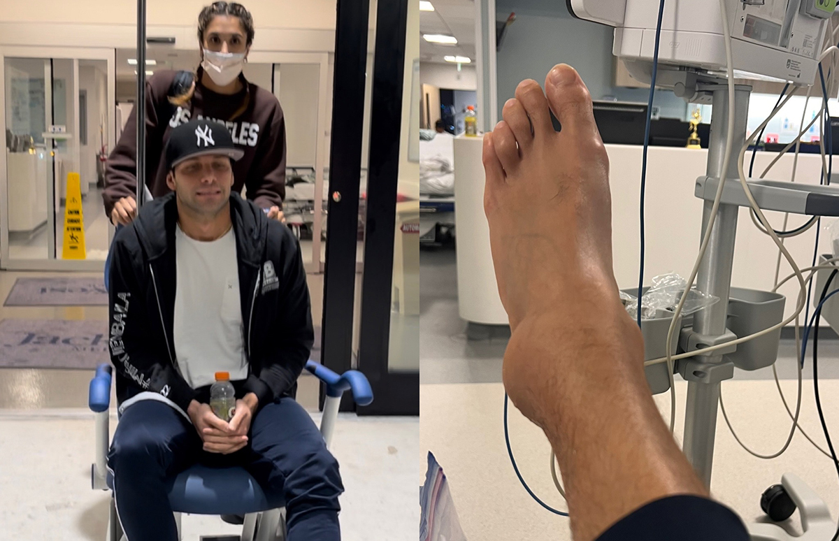 Así se veía el tobillo y pie de Gabriel Coronel después de la lesión en los ensayo de 'Mira Quién Baila All Stars'