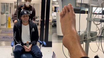 Así se veía el tobillo y pie de Gabriel Coronel después de la lesión en los ensayo de 'Mira Quién Baila All Stars'