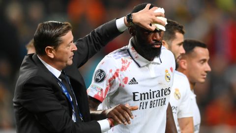 El defensor del Real Madrid, Antonio Rüdiger tras sufrir un fuerte choque en el partido de la Champions League ante el Shakhtar Donetsk.