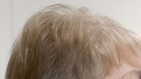 Le retiran a mujer más de 20 lentes de contacto de los ojos (VIDEO)