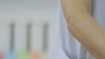 El exceso de peso ocasiona varias enfermedades