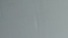 Perro casi le arranca el brazo a ladrón, familia del delincuente pide que lo sacrifiquen