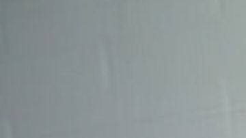 Perro casi le arranca el brazo a ladrón, familia del delincuente pide que lo sacrifiquen