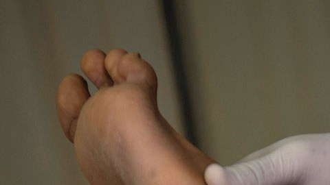Lentamente se propagan los contagios en México