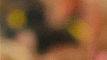 El lateral tiene una contusión craneal.