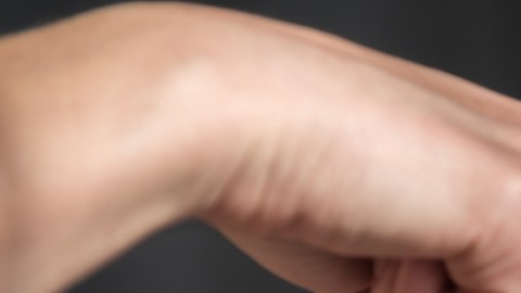 Implantes mamarios resultan con una capa similar a cemento blanco en una paciente de solo 25 años: qué le pasó