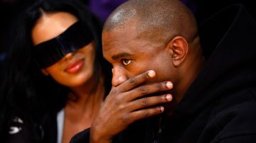 Imagen de Kanye West con la mano en el rostro.