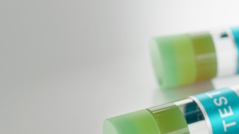 Viruela del mono: pacientes con VIH son más vulnerables a la infección según los CDC