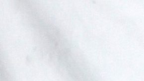 Laura Bozzo se somete a tratamiento estético.