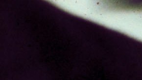 Comienzan ensayos de vacuna contra el cancer de pulmón