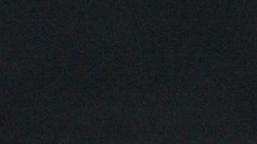 Si bien muchas personas no consideran la calvicie un problema de salud significativo, puede llegar a ser traumático en personas con alopecia areata severa.