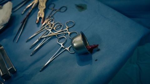 Madre de dos hijos será diseccionada públicamente en la TV británica después de morir de raro cáncer a los 30 años