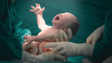 Bebés nacidos por cesárea tienen una respuesta más débil a las vacunas: por qué