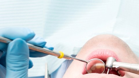 CDC alertan sobre infecciones contraídas en consultorios de dentistas