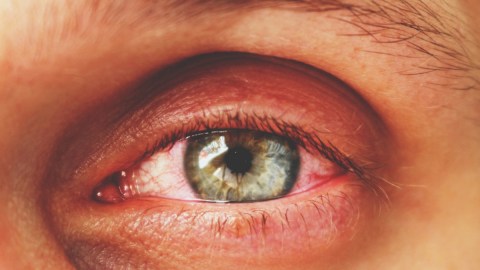 Sufrir estrés de modo constante contribuye al envejecimiento prematuro de tus ojos