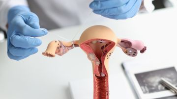Síndrome de ovario poliquístico: esto es lo que debes saber si quieres tener un bebé