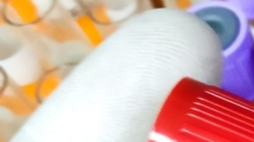 Viruela del simio: OMS mantiene la emergencia sanitaria mundial