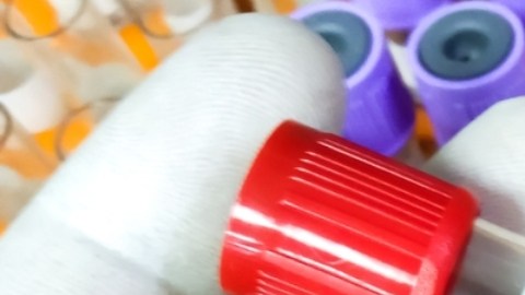 Viruela del simio: OMS mantiene la emergencia sanitaria mundial
