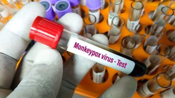 Viruela del simio: OMS mantiene la emergencia sanitaria mundial