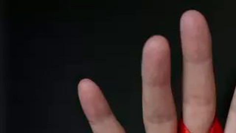 Los 3 avances más esperanzadores en la lucha contra el VIH/Sida (y para aquellos que viven con el virus)