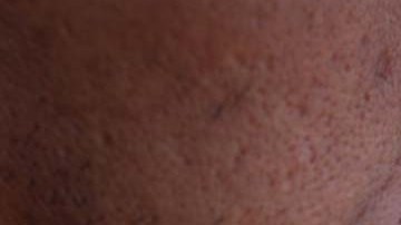 Los cigarros, el tabaco de pipa o cualquier otro producto de tabaco encendido queda prohibido en las playas de Miami Beach