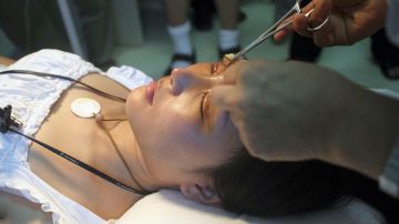 Esta joven japonesa ha gastado US$100 mil en su “adicción” a las cirugías plásticas