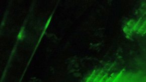 La luz verde podría aliviar el dolor