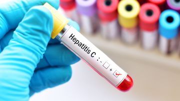 Hepatitis C en Inglaterra