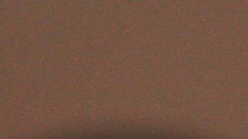 Dos gemelas siamesas son separadas tras una "cirugía histórica" de 11 horas en Texas