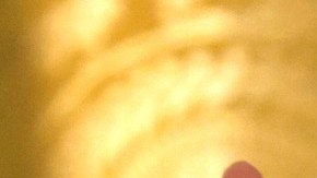 Primera dama Jill Biden se someterá a una intervención quirúrgica la próxima semana