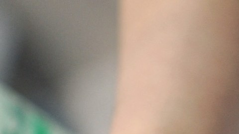 Mujer de California contrajo raro cáncer de en un salón de belleza, casi pierde el dedo