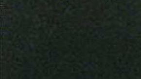 Un alto consumo de bebidas azucaradas podría dejarte calvo: estudio