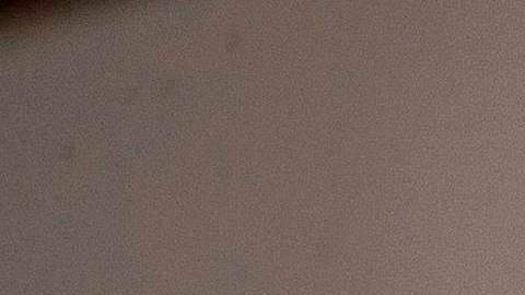 ONU lanza nueva alarma, superbacterias se encaminan a matar a millones de personas en el mundo