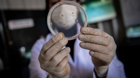 CDC advierten sobre superbacteria estomacal como grave amenaza para la salud pública