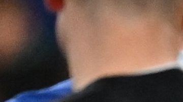 César Azpilicueta recibiendo asistencia médica.