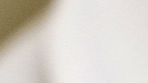 ARLINGTON, VA - JUNE 05: Recently laid off worker Lyn Talent receives a free Botox injection during an event called the "The Botox Bailout" where the first 50 recently laid-off workers could exchange their resumes for free Botox injections June 5, 2009 in Arlington, Virginia. The event, which took place in a Reveal store, also featured recruiters to help job seekers network, collect resumes and offer on-site interviews. (Photo by Win McNamee/Getty Images)