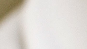 ARLINGTON, VA - JUNE 05: Recently laid off worker Lyn Talent receives a free Botox injection during an event called the "The Botox Bailout" where the first 50 recently laid-off workers could exchange their resumes for free Botox injections June 5, 2009 in Arlington, Virginia. The event, which took place in a Reveal store, also featured recruiters to help job seekers network, collect resumes and offer on-site interviews. (Photo by Win McNamee/Getty Images)