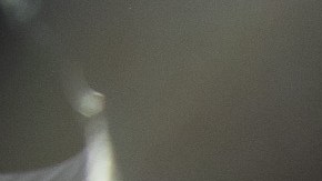 Niño de 7 años rescatado de los escombros en Turquía, hace llorar al médico que le salvó la vida