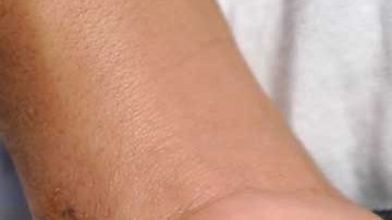 Las mascotas de Christian Alexander ya tenían un reporte previo de agresión