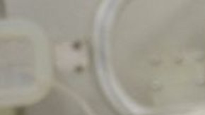 La bebé se encontraba estable en un hospital después de llegar con hematomas, laceraciones e hipotermia.