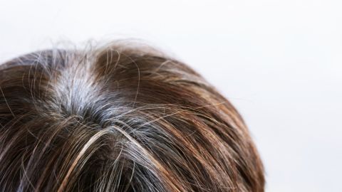 Canas prematuras son indicador de problemas de corazón y cerebro: qué debemos saber