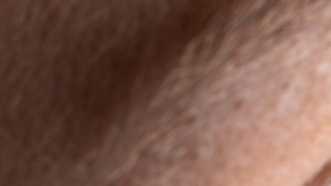 La obesidad puede causar ceguera, según estudio