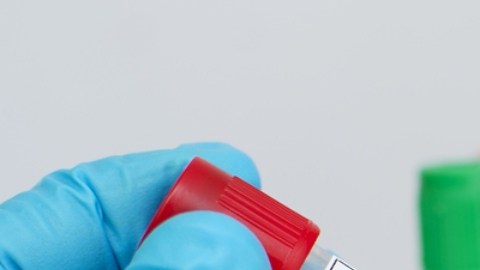 Mpox es fatal para las personas con VIH: qué dicen los investigadores