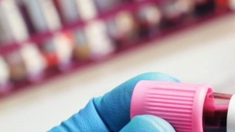 Mpox casi erradicada en Estados Unidos: qué debemos saber