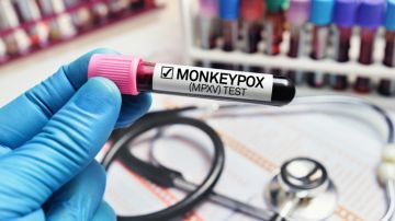 Mpox casi erradicada en Estados Unidos: qué debemos saber